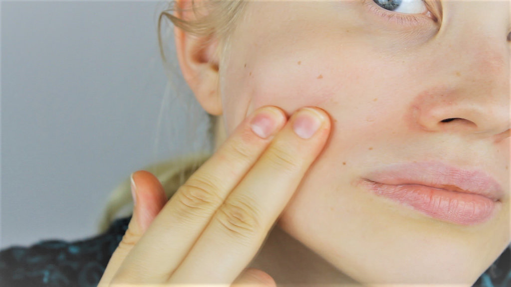 Living with Eczema: The Ongoing Challenge