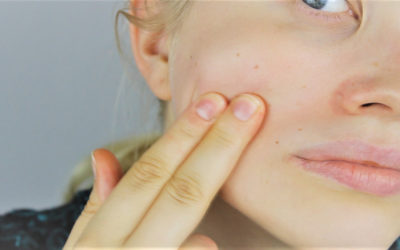 Living with Eczema: The Ongoing Challenge